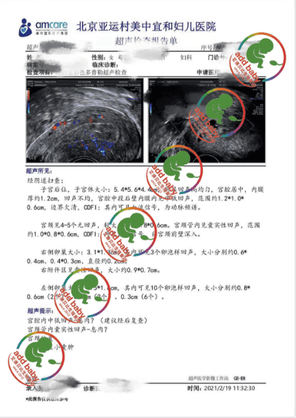 W女士的故事:46岁终于当上妈妈